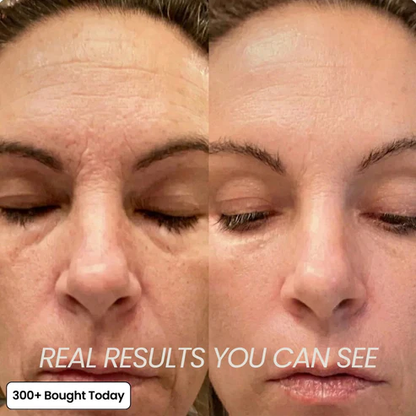 🔥LAST DAY 60% OFF Tomlisse Korean Pink Collagen Volume Multi Balm