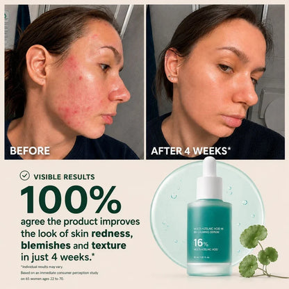 Multi-Azelaic Acid Calming Serum