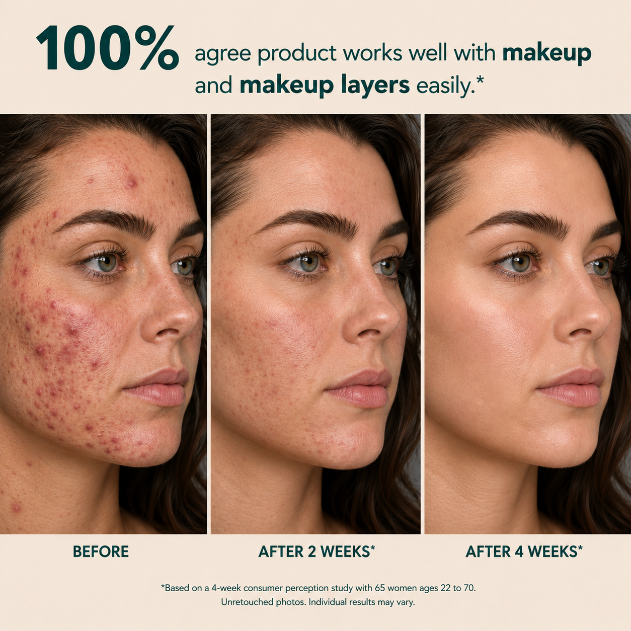 Multi-Azelaic Acid Calming Serum