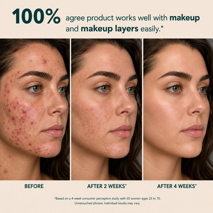 Multi-Azelaic Acid Calming Serum