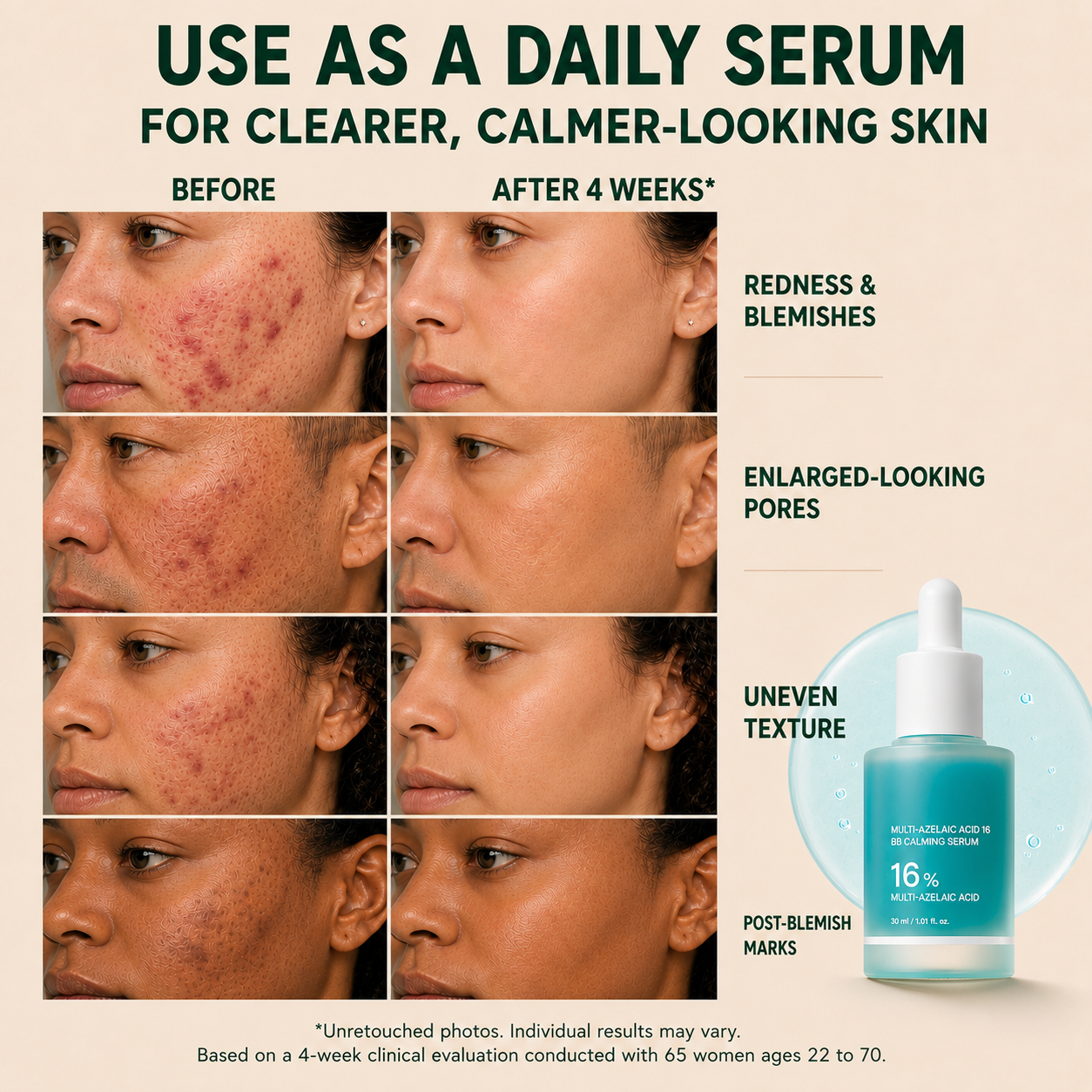 Multi-Azelaic Acid Calming Serum