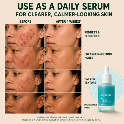 Multi-Azelaic Acid Calming Serum