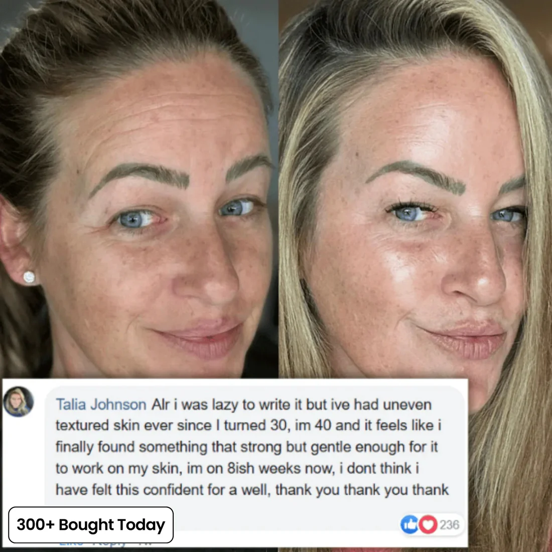 🔥LAST DAY 60% OFF Tomlisse Korean Pink Collagen Volume Multi Balm