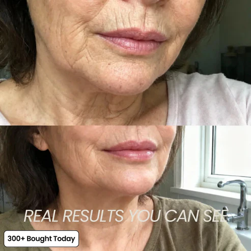🔥LAST DAY 60% OFF Tomlisse Korean Pink Collagen Volume Multi Balm