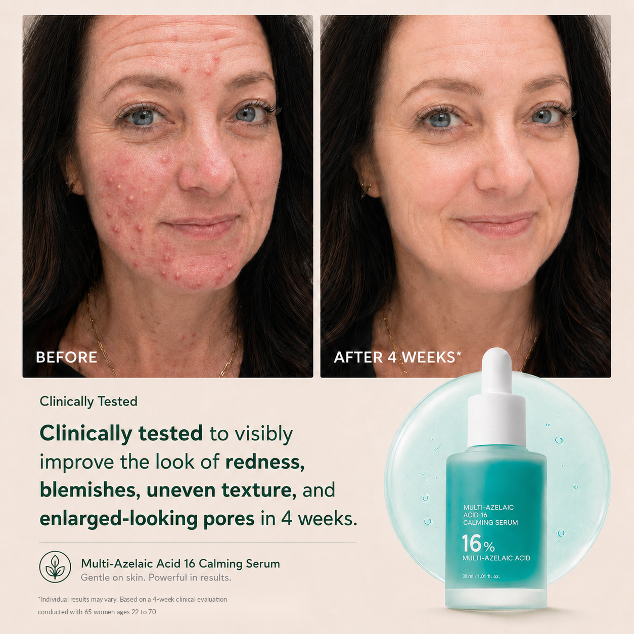 Multi-Azelaic Acid Calming Serum