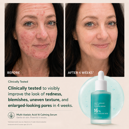 Multi-Azelaic Acid Calming Serum